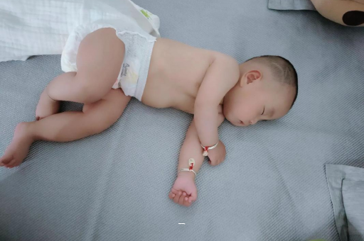 湘潭宝宝脸上有白色斑块